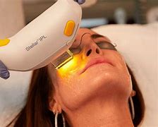 20% OFF IPL Laser series of 3